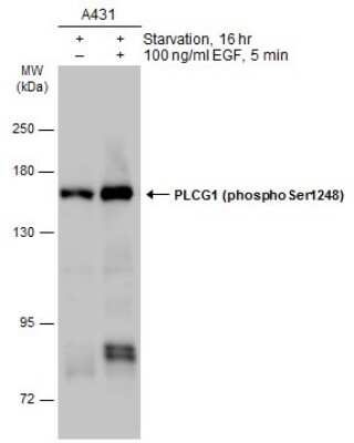 Western Blot: PLC-gamma 1 [p Ser1248] Antibody [NBP3-13252]